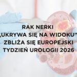 Model nerki przedstawiający guz nowotworowy, trzymany przez osobę w rękawiczkach medycznych